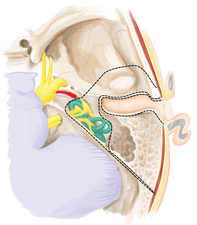 temp-bone-axial.jpg