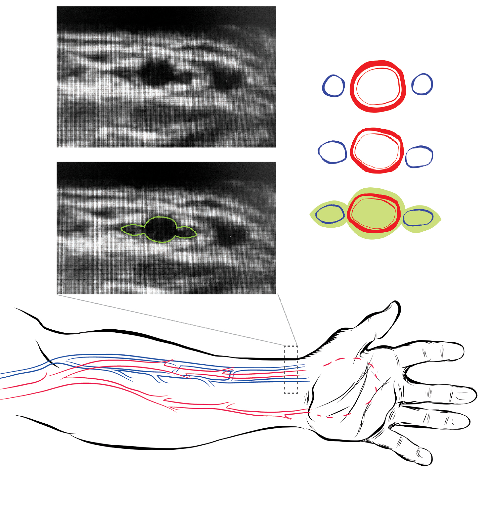 arm-schematic-2.jpg