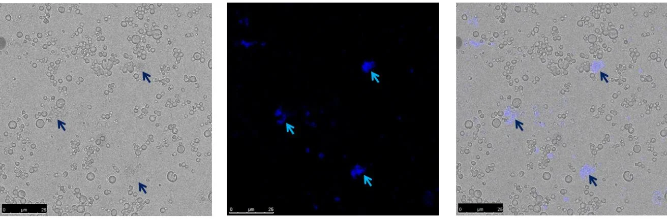 Figure 2: Bright field, DAPI-stained and DAPI-BF merged images of the nuclei isolated with the protocol of Dr. Ivan Llorens. The blue arrows point to DAPI-stained nuclei which were clumped together.