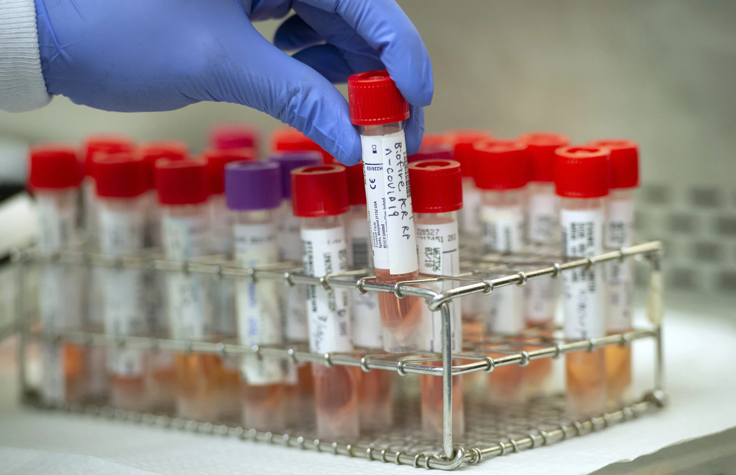 Upstate regions struggle to meet testing benchmark for COVID reopening By Luke Perry