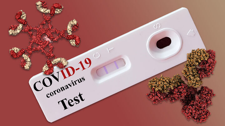 Can antibody tests tell us who is immune to COVID-19? By Shayan Sharif and Byram W. Bridle