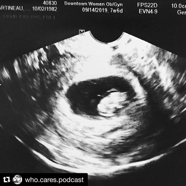 workin on a new bit!
・・・
Ep. 67 - Who cares about sonograms?? Pregnancy, sonograms, Whitesnake, oh my! What do these things have in common? Absolutely nothing of course. Somehow Patrick and Ross end up talking about 80&rsquo;s hair metal after they&r