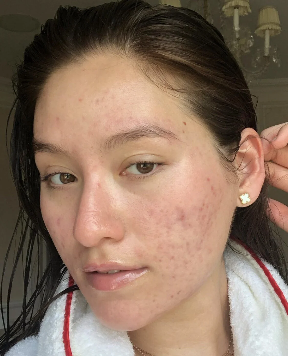 Food As Medicine: Healing The Skin From Within