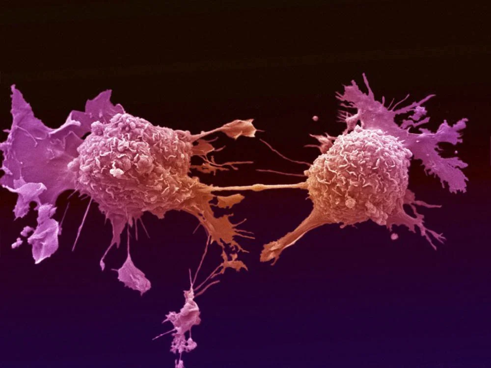 lung-cancer.jpg