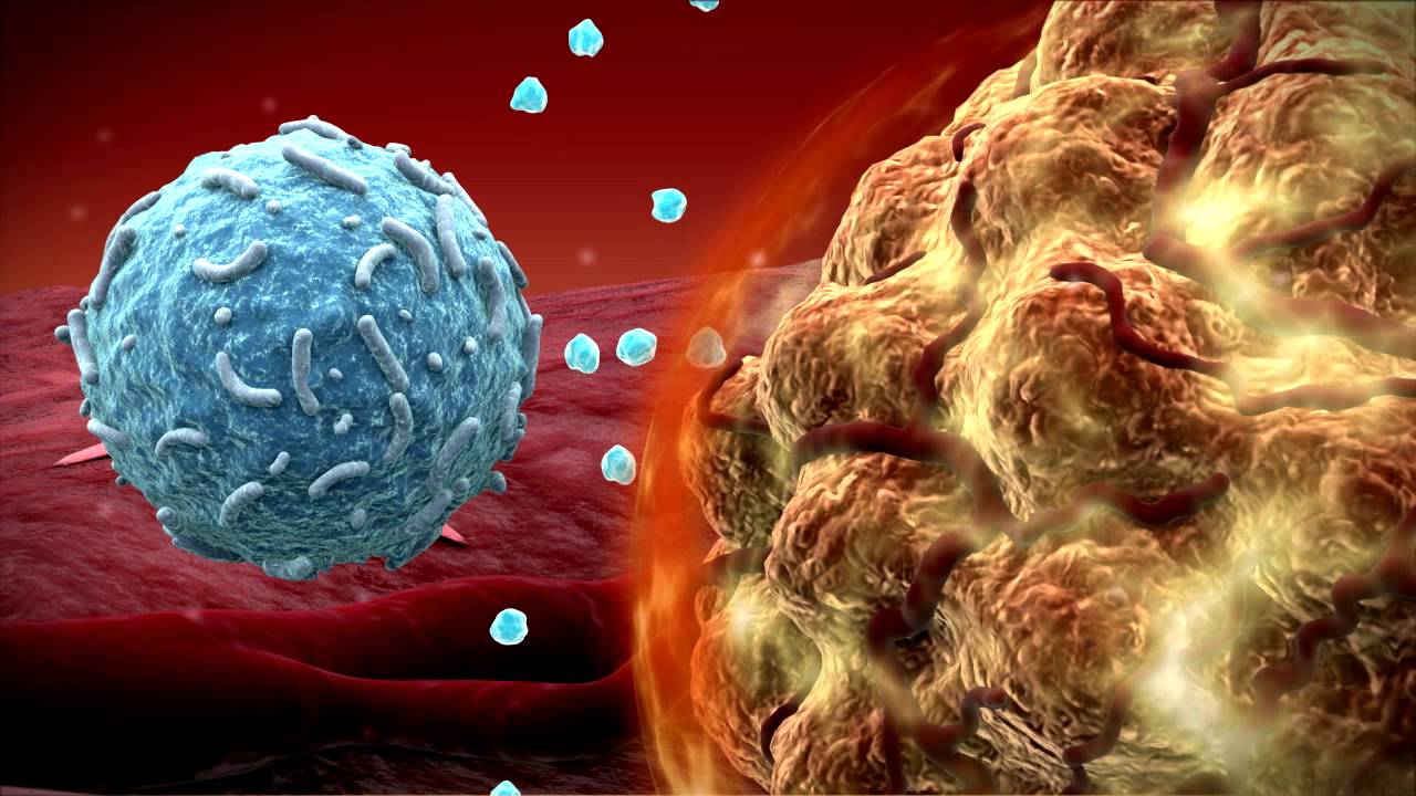 Immunotherapy for Melanoma: Photo courtesy OfficialScience20