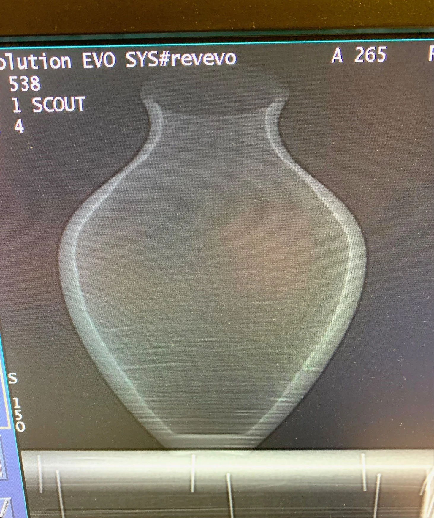 Christopher Vase CT image.jpeg