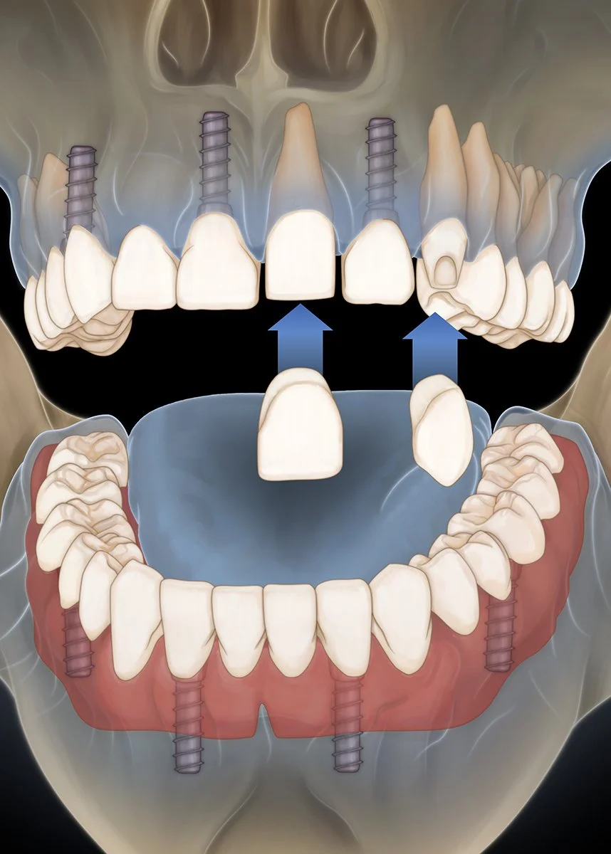 Reconstruction (X-Ray).jpg