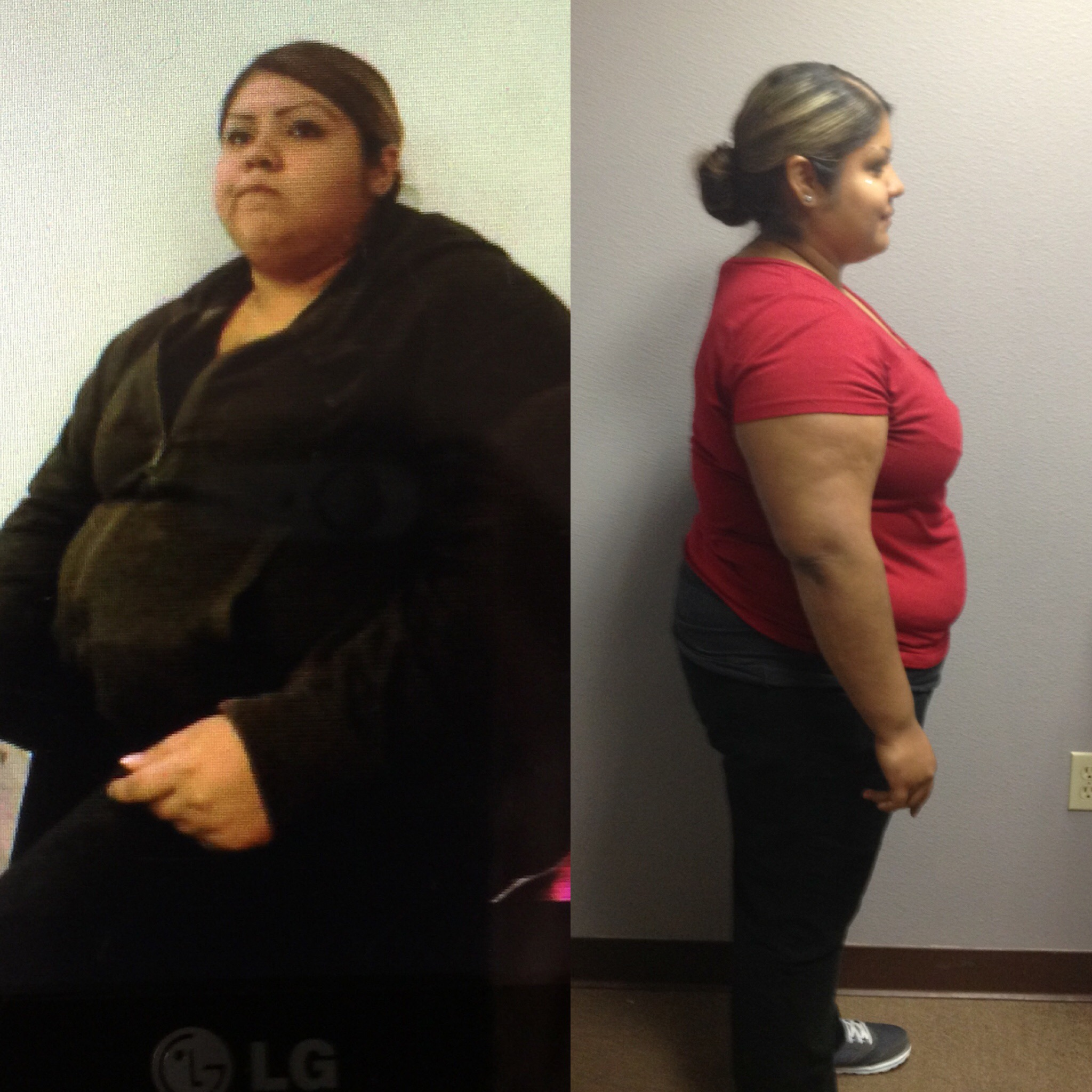 Testimonials Image Medical Weight Loss Center