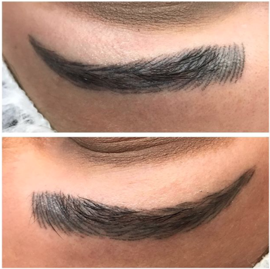 HEALED blade + shade results!