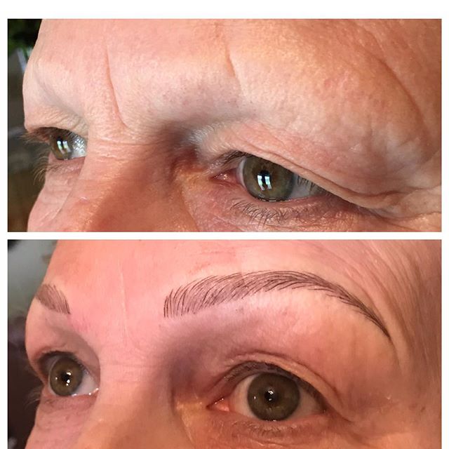 Lots of my clients come in thinking you have to have existing hair to be a good candidate for microblading. Not true! These will heal to a softer look, then we’ll at a little more density and possible some powdery shading at her touchup to really bring them to life!