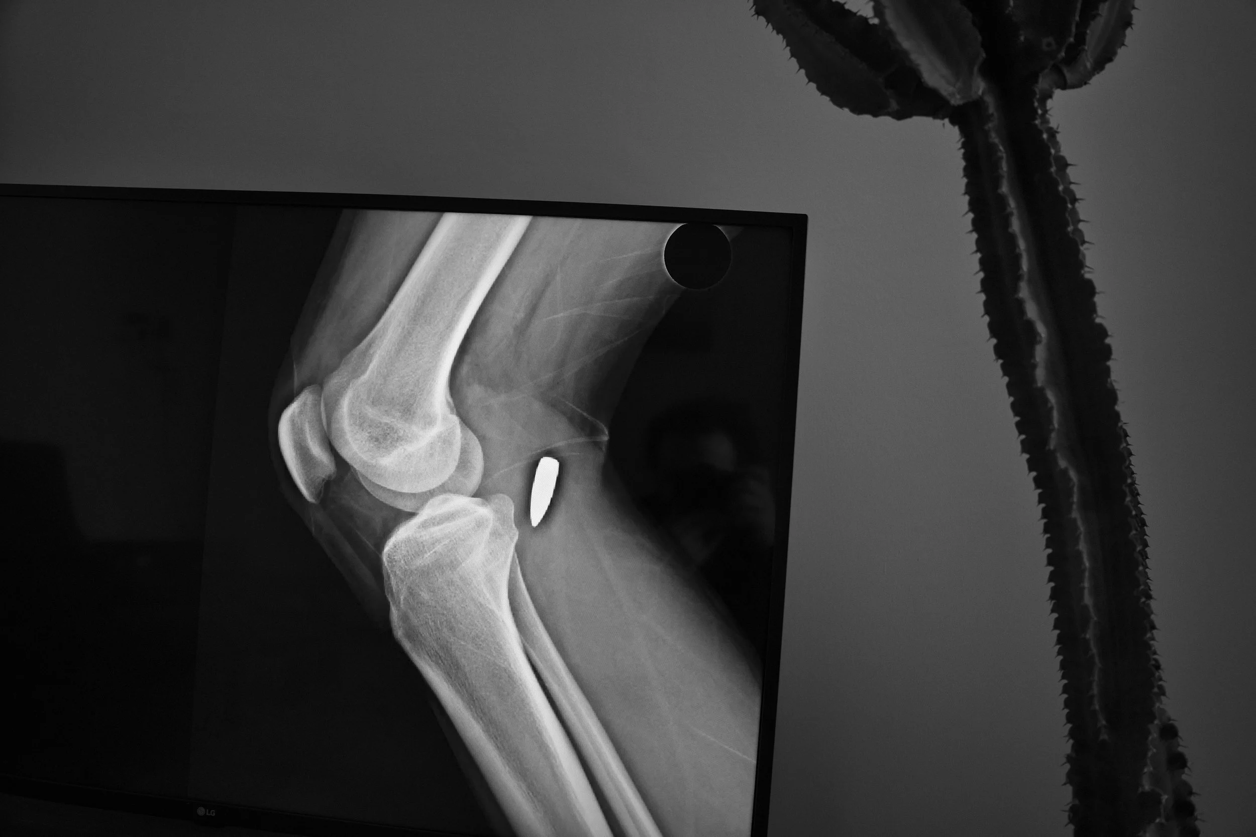 01- Ebrahimalipoor -  Bullets have no borders12.JPG