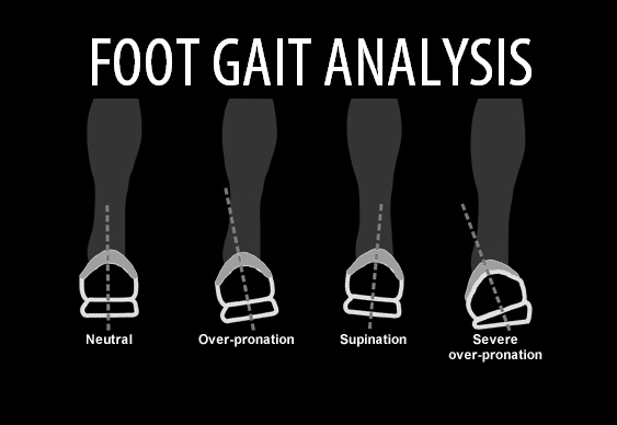 Foot Gait Analysis.jpg