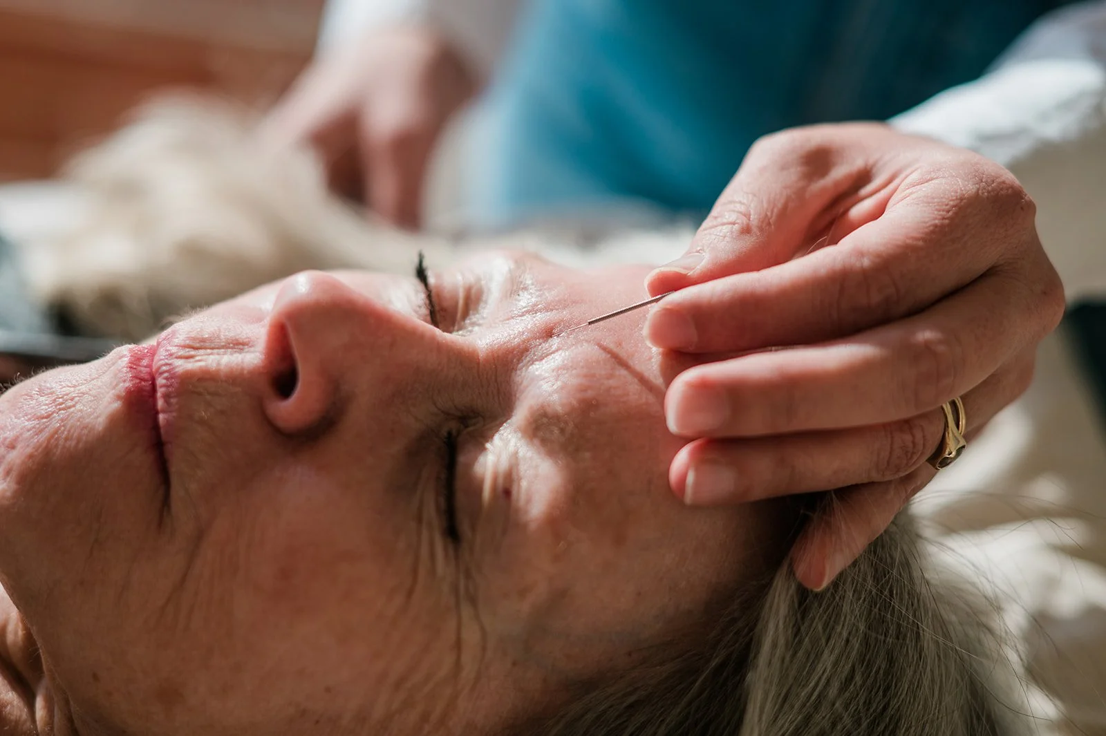 Acupuncture Treatments — MOON RIVER ACUPUNCTURE CLINIC