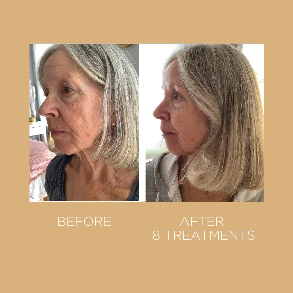 Facial Acupuncutre — MOON RIVER ACUPUNCTURE CLINIC