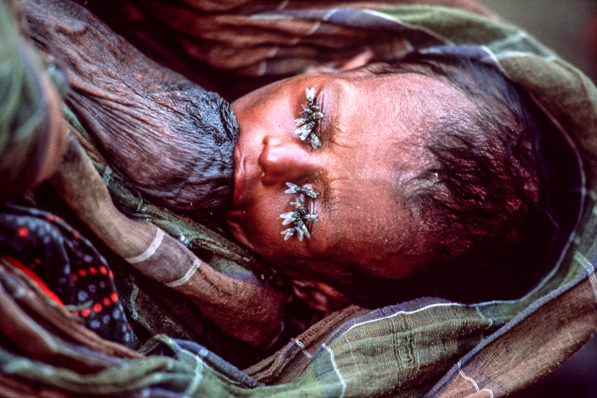  Bardera, Somalia - December 1992 A child with his eyes covered by flies, tries to drink milk from the mother's shriveled breast. 