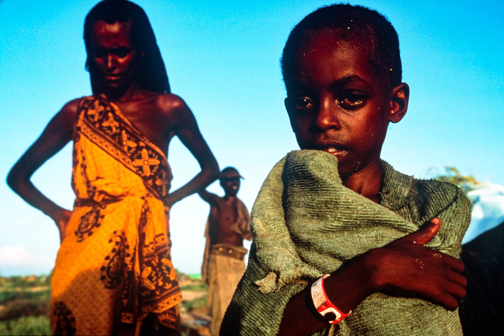 Bardera, Somalia - December 1992 The intense glance of a child who is longing for some food.