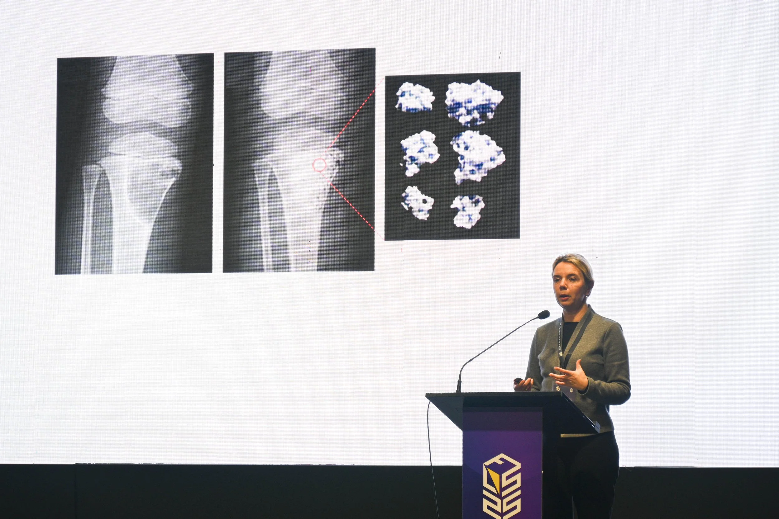 Regenerative Medicine: Challenging the Body to Repair Itself