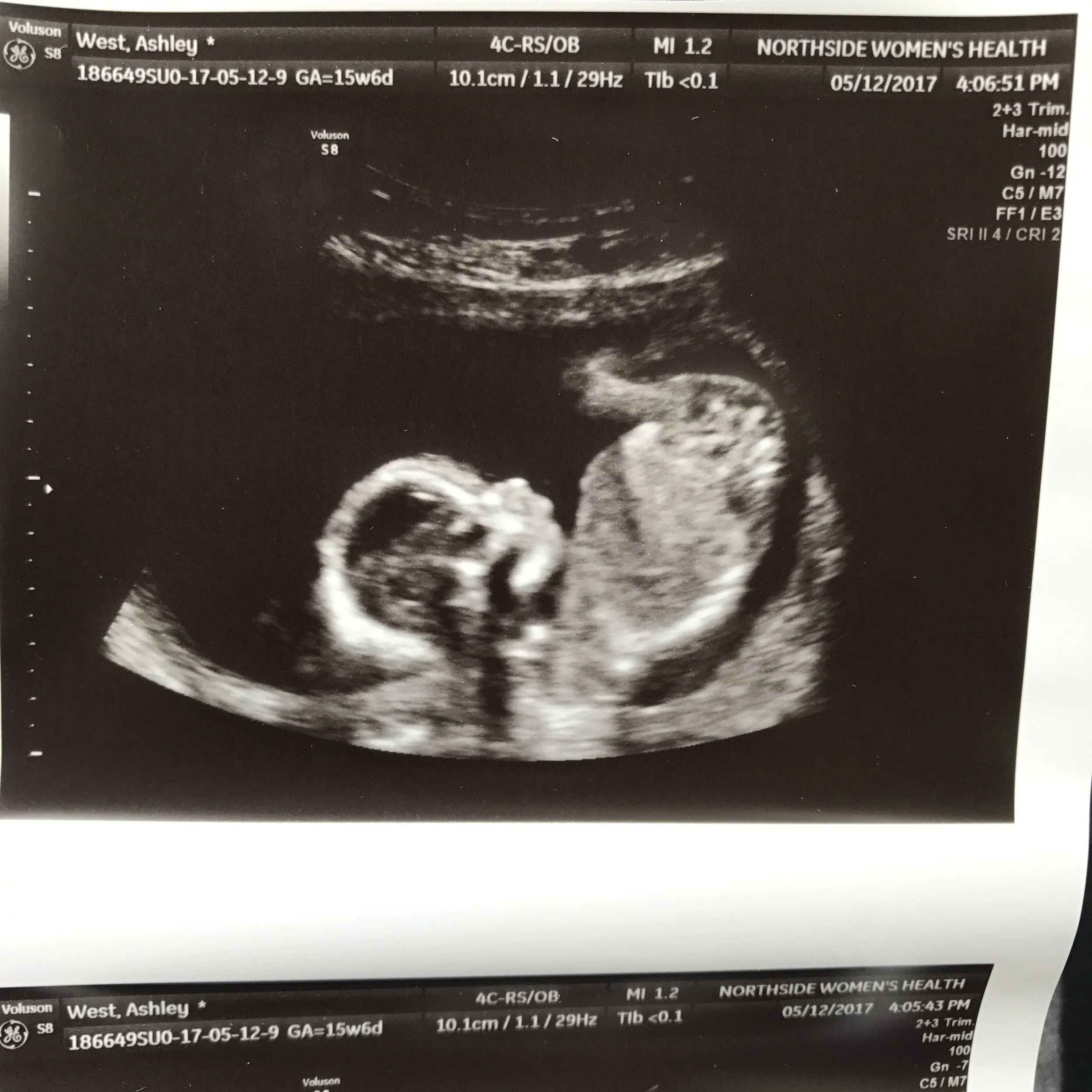 The First Trimester -- FINALLY! An update about our baby boy on the way...