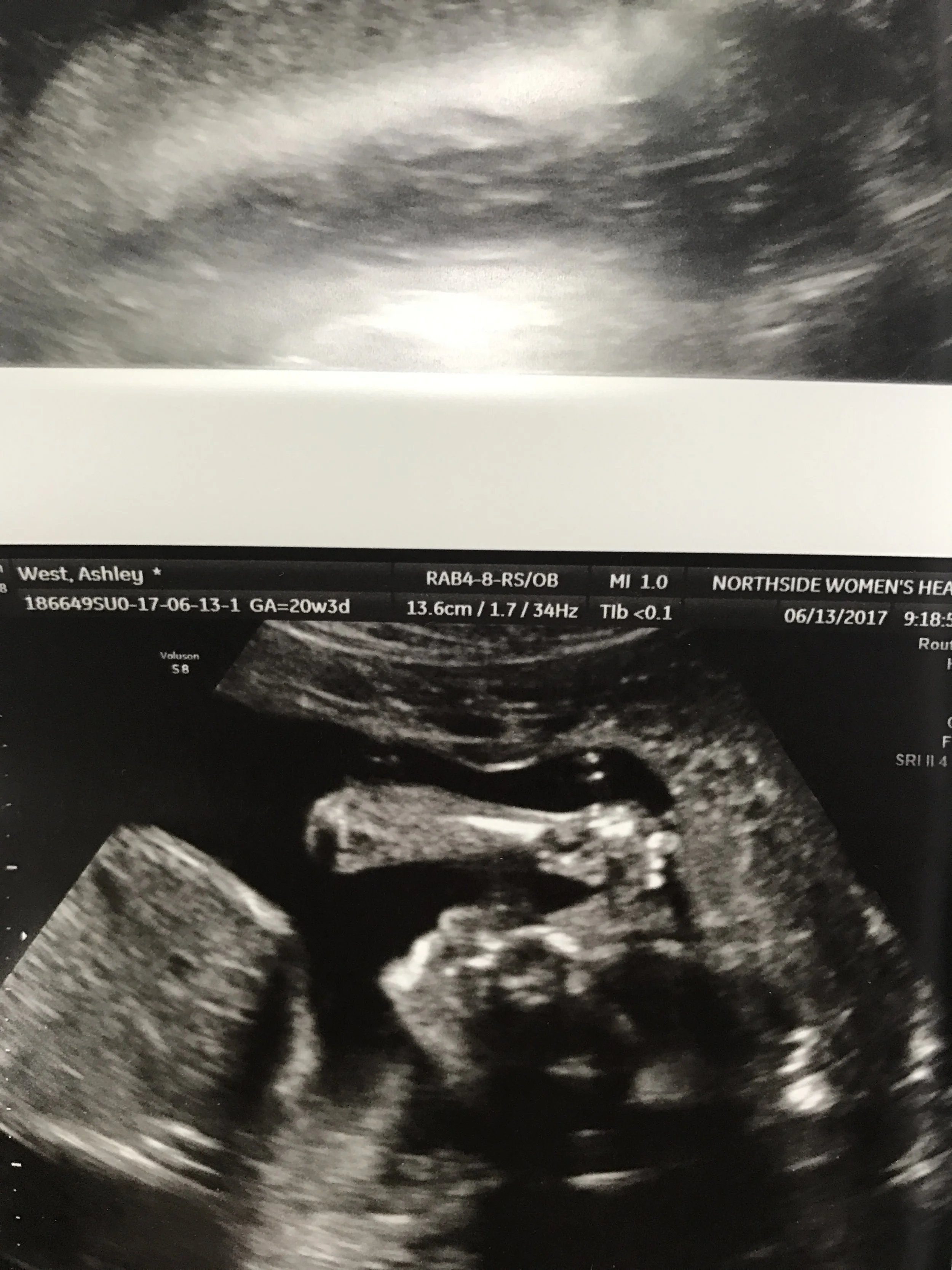 See his little face!?!? He's holding up his arm. HOW DO I LOVE HIM SO MUCH ALREADY. 20 week anatomy scan.