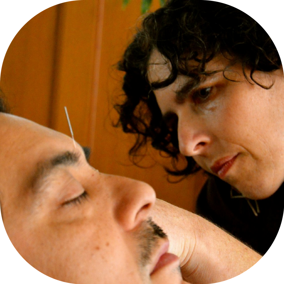 Facial acupuncture treatment photo