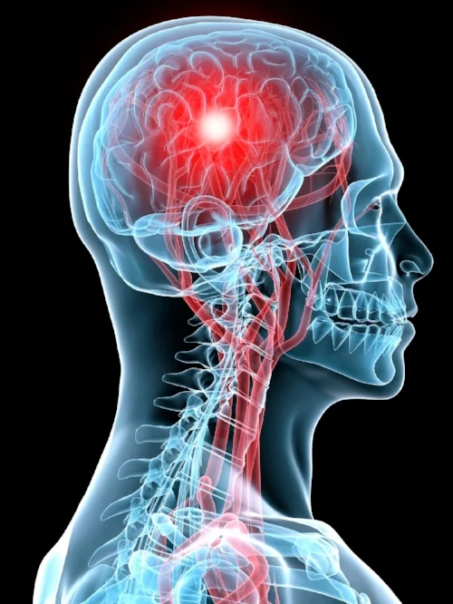 Concussion Head.jpg