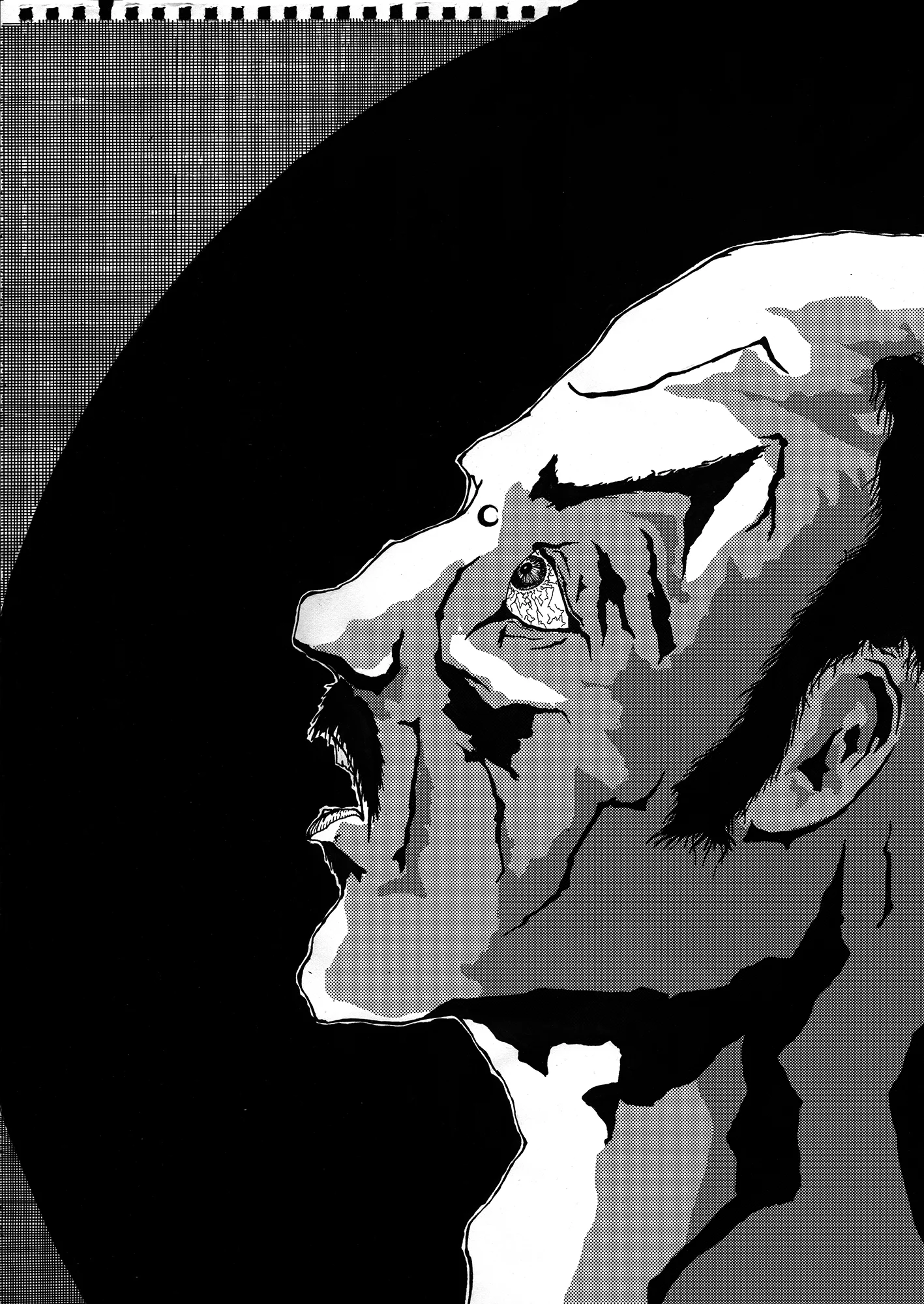 Broken jaw