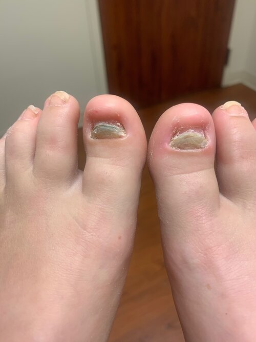 Help! I Have Ugly Toenails! — Dr. cary gannon