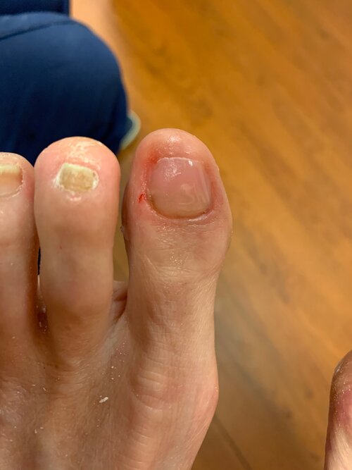 Help! I Have Ugly Toenails! — Dr. cary gannon Help! I Have Ugly Toenails! — Dr. cary gannon