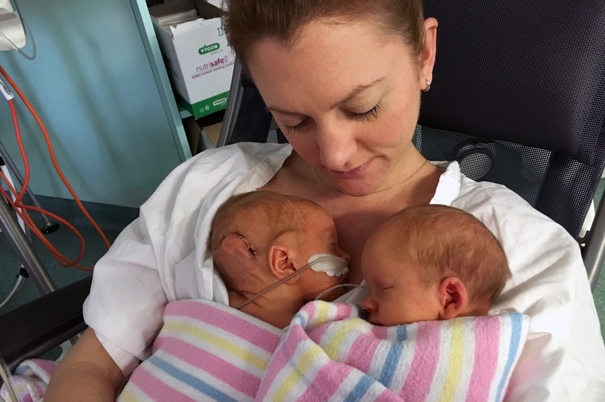 The best thing that you can do for your baby is frequently hold them skin-to-skin on your chest