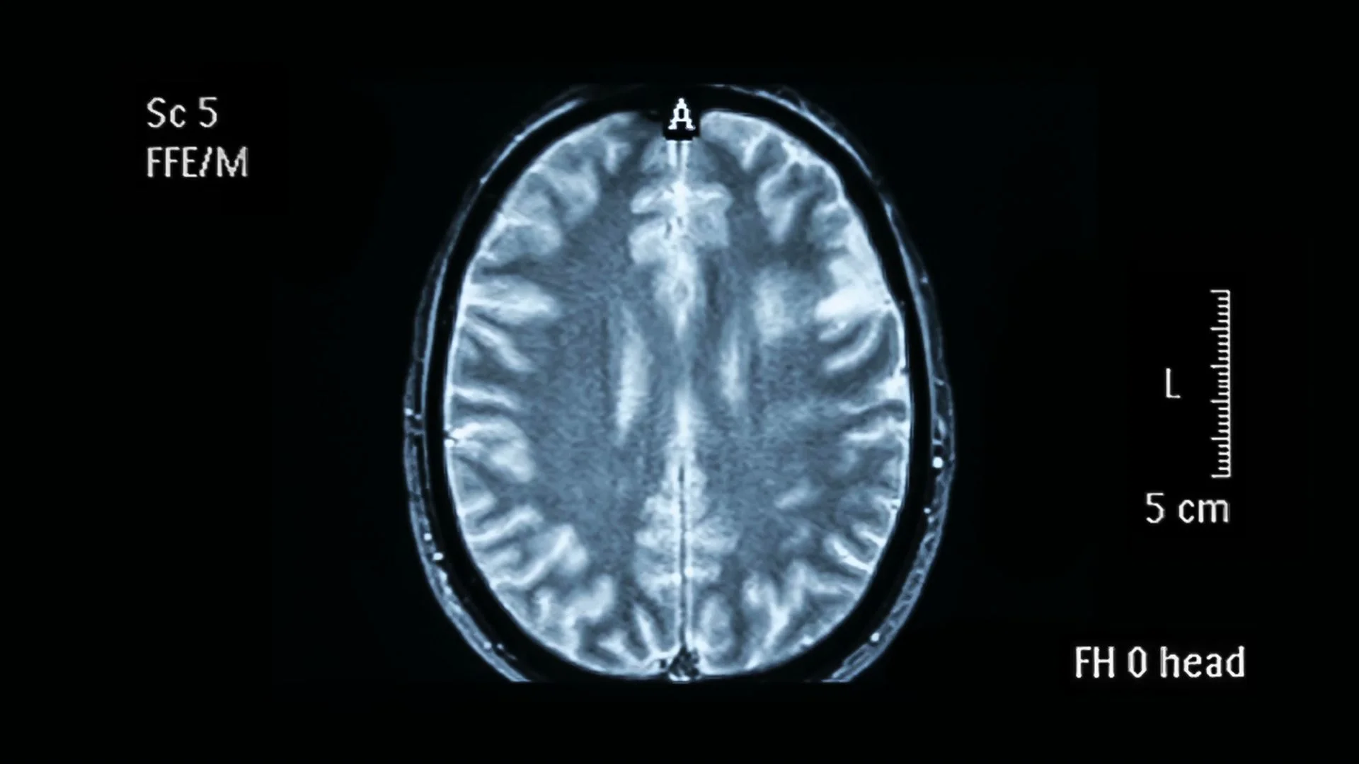 Zansors Tools to Help Veterans with Sleep Disturbances