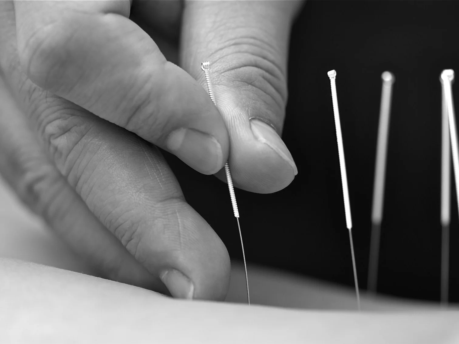 Reactivate Muskoka acupuncture