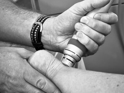 Reactivate Muskoka shockwave therapy achilles tendonitis