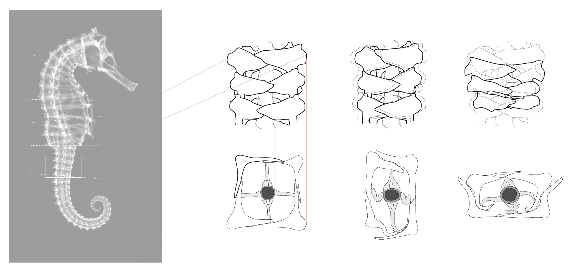 extracting plan and elevation views of bony plate