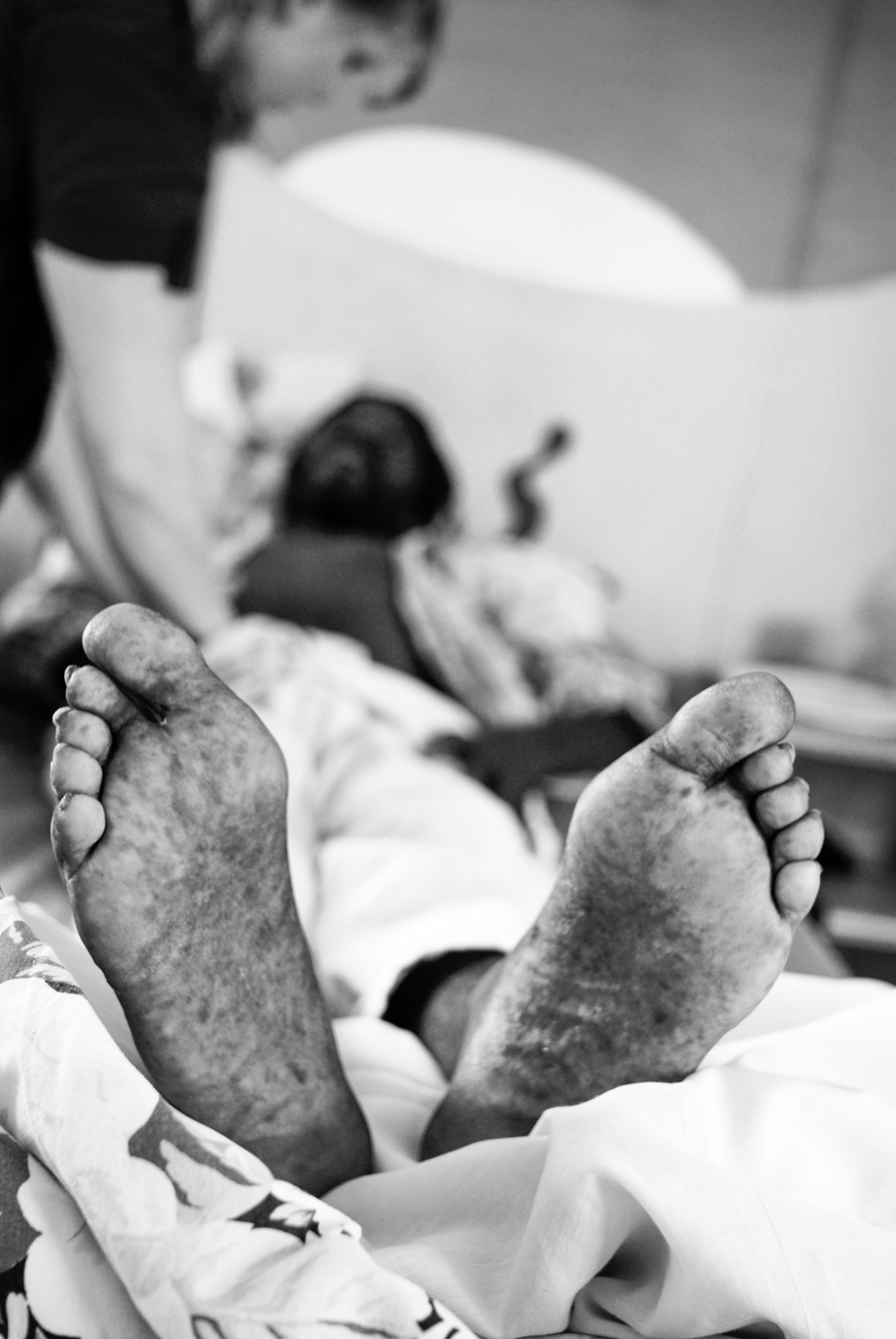 This patient had been bedridden within the treatment centre for over 6 months due to a combination of opportunistic infections and tuberculosis. After returning home for a brief period he returned he returned where I photographed him being e
