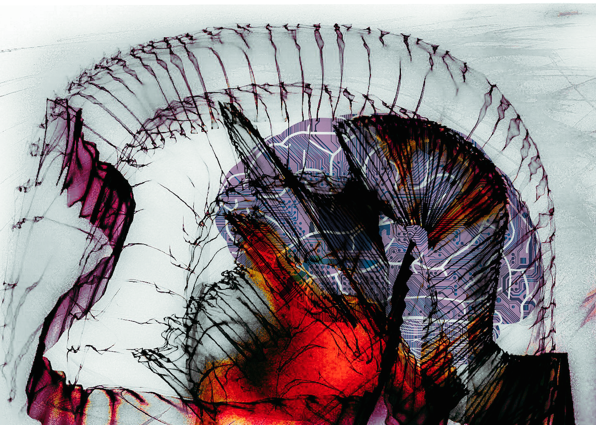 The Localization of Consciousness
