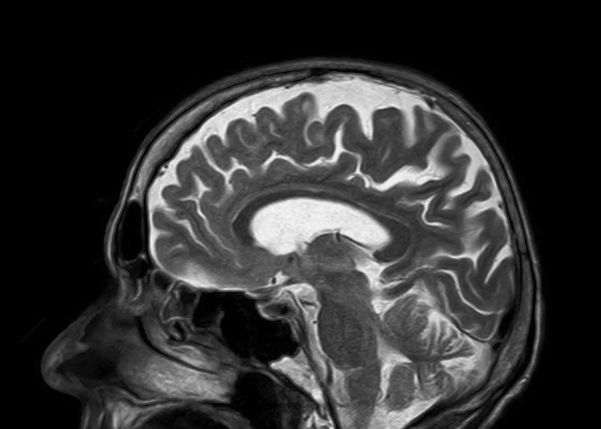 CC #19: Learning About the Brain and Brain-Inspired Learning