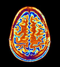 fMRI brain scan: © Getty Images