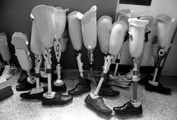 Prosthetic plastic legs 1980s