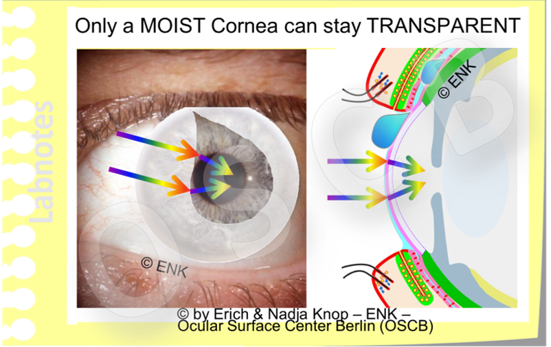 Only a MOIST Cornea can stay TRANSPARENT