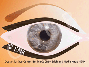 Eye Movements and Blinking produce FRICTION
