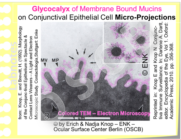 Micro-projections of the epithelial cells of the human ocular surface (here the conjunctiva) occur in form of finger-like microvilli and fold-like microplicae . The cell membrane that surrounds them has numerous integrated long glycoproteins (colored her in pink) that radiate into the surrounding aqueous surface milieu . The glycocalyx has a high water binding capacity and maintains the wettability of the epithelial cell surface.