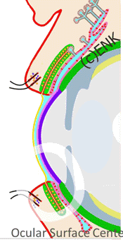 During the eye BLINK the upper lid moves over the cornea and conjunctiva. In the down-phase the ´old´tear film is compressed and in the up-phase a new thin pre-ocular tear film is spread over the bulbar surface. This schematic drawing greatly exaggerates the thickness of the tear film in order to make it visible at this enlargement. The tear film thickness is presently found to be typically under the height of one conjunctival epithelial cell.