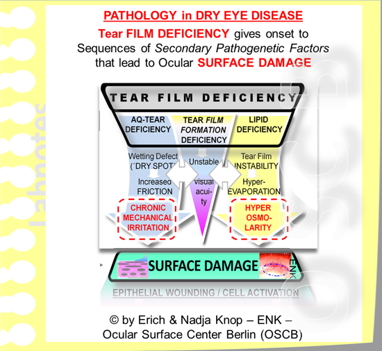 Tear Film Deficiency typically leads to Damage of the Ocular Surface. This occurs via Sequences of Secondary Pathogenetic Factors in the tear film dynamics that eventually lead to chronic mechanical irritation and hyper-osmolarity.