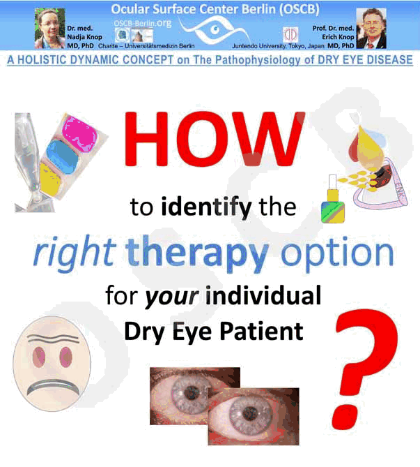 OSCB-GIF 3.11_HOW to UNDERSTAND the Ocular Surface and Dry Eye Disease.gif
