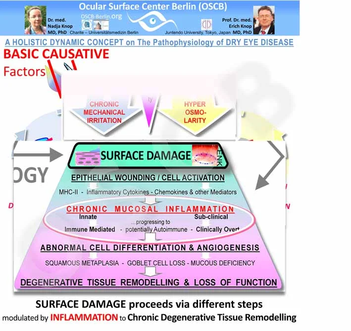 Secondary Pathogenetic Factors in SURFACE Tissue DAMAGE also form Sequences of increasing severity that propagate the disease process. Chronic inflammation is the main amplifier of disease - it gives rise to several Vicious Circles and to a Chronic Tissue Remodeling with Loss of Function .