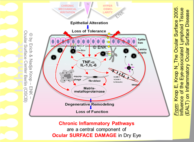 Chronic Inflammatory Pathways are a central component of the disease process of Dry Eye during Ocular Surface Tissue Damage . This is induced by the initial epithelial alterations due to tear film deficiency and may proceed into an immune-mediated mucosal inflammation , if it is not interrupted by therapeutic intervention, to a Degenerative Tissue Remodelling with Loss Of Function .