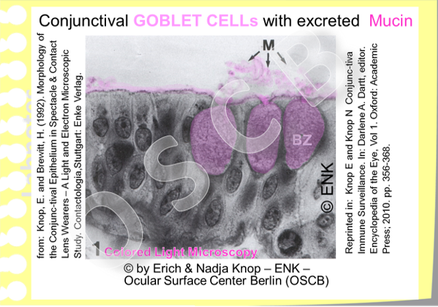 The CONJUNCTIVA of the FORNIX has a multi-layered epithelium, which certainly contains goblet cells for production of the water-binding mucins. The cells in the surface layer are cuboidal or, as seen here, often columnar. (Mucins in the Goblet cells and on the surface are artificially colored on the photo)