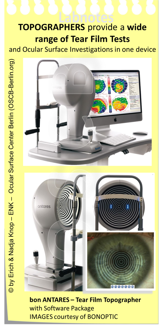 TOPOGRAPHERS are Multi-Purpose devices that are stand-alone, are typically equipped with different illumination systems for different purposes and are connected to a computer with an appropriate software system for evaluation and storage of examination results. Certainly very useful for Dry Eye Diagnostics is the possibility to perform Non -Invasive Tear Film Break-Up (NI-BUT) measurements that allow the measurement of Tear Film stability without interfering with it by addition of marker any substances.