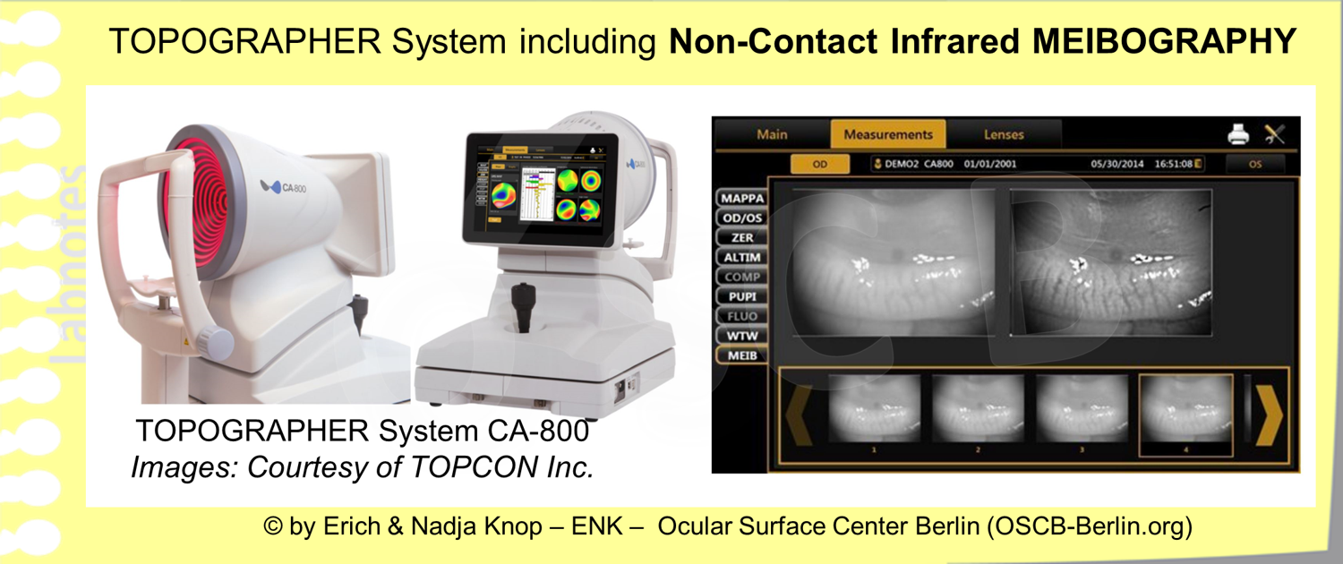 Topographer Systems are typically more advanced. They usually provide more advanced illumination annd visualization techniques and a better image quality together with measurements and a structured documentation that can make the clinical daily life more effective and enjoyable.