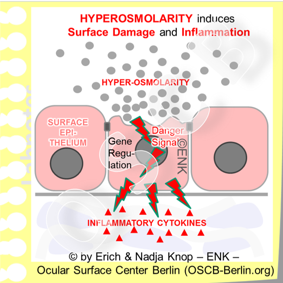 The schematic drawing illustrates the impact of a local spot of hyper-osmolarity that may occur e.g. due to a local break-up of the tear film with local evaporation of water and accumulation of the remaining tear salts and proteins (gray spots). The hyper-osmolarity drags water from the epithelial cells with potential shrinkage and cell disruption. This represents a danger signal and activates an inflammatory response with production of inflammatory mediators. In chronic conditions and with wide-spread hyper-osmolarity a pro-inflammatory milieu may build up that can lead to the onset or promotion of Dry Eye Disease. (for schematic reasons the local hyper-osmolarity zone here is much too small because it may be assumed that even a small local hyper-osmolarity will affect several or many cells at a time).
